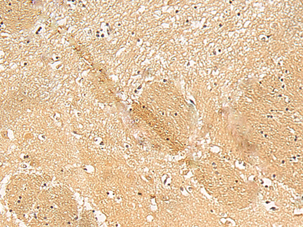Rabbit Polyclonal Antibody to TXNDC12