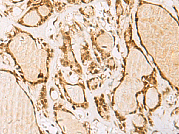 Rabbit Polyclonal Antibody to NIPBL