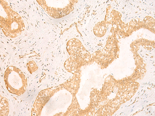 Rabbit Polyclonal Antibody to GSG1L