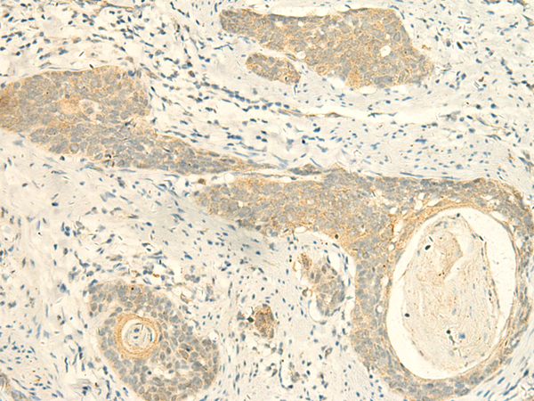 Rabbit Polyclonal Antibody to MPV17