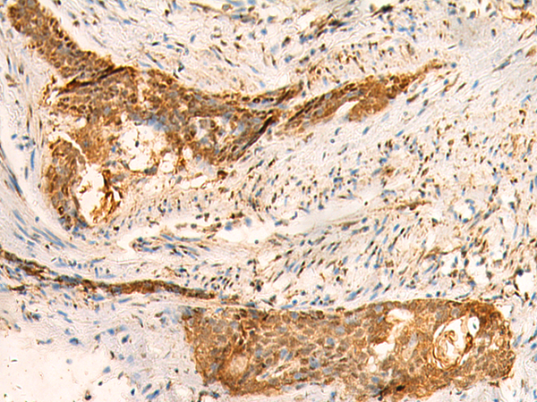 Rabbit Polyclonal Antibody to SMUG1