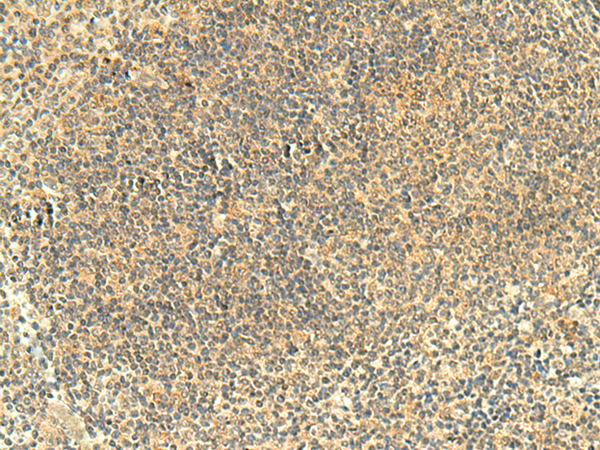 Rabbit Polyclonal Antibody to FMNL2