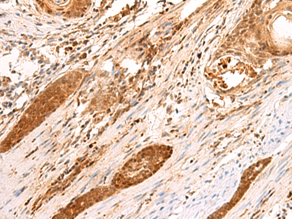 Rabbit Polyclonal Antibody to SCAND1
