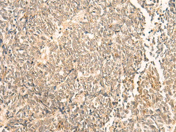 Rabbit Polyclonal Antibody to NIP7