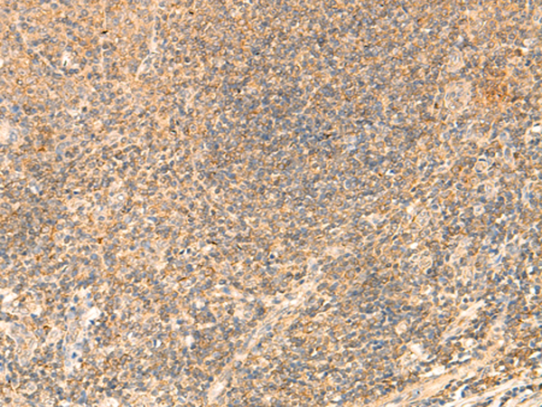 Rabbit Polyclonal Antibody to PDAP1