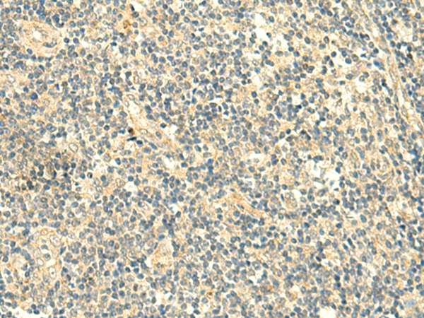 Rabbit Polyclonal Antibody to TMEM9