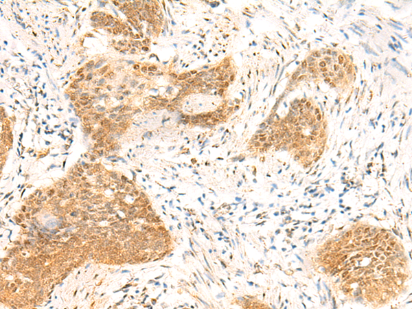 Rabbit Polyclonal Antibody to TBPL1
