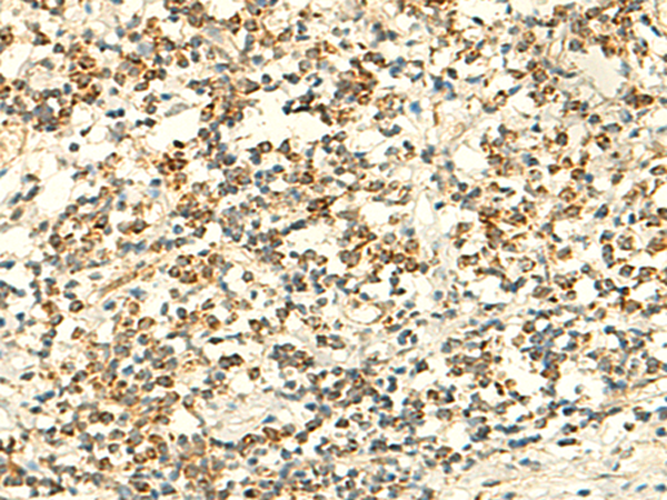 Rabbit Polyclonal Antibody to IFT27