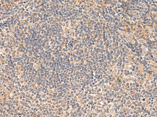 Rabbit Polyclonal Antibody to FUNDC2