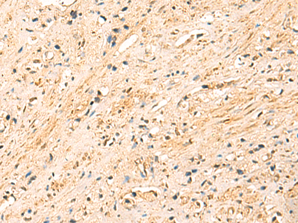 Rabbit Polyclonal Antibody to EEF1AKMT2