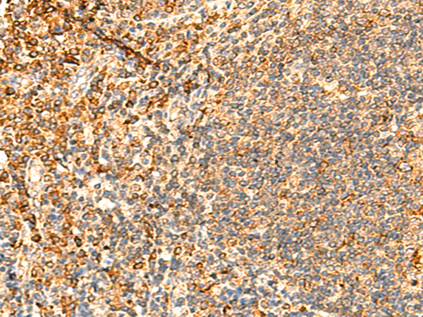 Rabbit Polyclonal Antibody to PPM1B