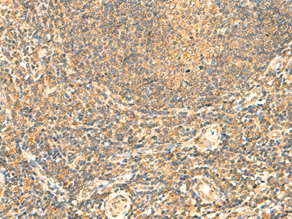 Rabbit Polyclonal Antibody to LYZL1