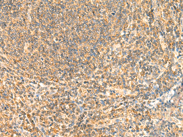 Rabbit Polyclonal Antibody to ZNF581