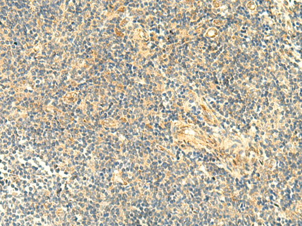 Rabbit Polyclonal Antibody to ASB6