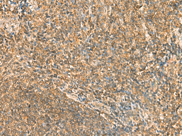 Rabbit Polyclonal Antibody to ZNRD2