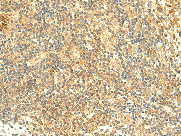 Rabbit Polyclonal Antibody to ARL4D