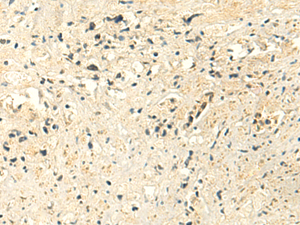 Rabbit Polyclonal Antibody to MTHFS