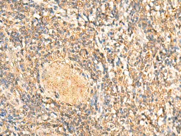 Rabbit Polyclonal Antibody to RAB1A