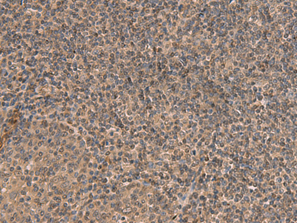 Rabbit Polyclonal Antibody to HEBP2