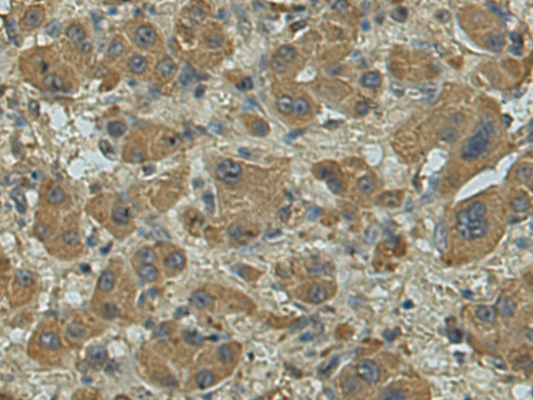 Rabbit Polyclonal Antibody to TCEANC2