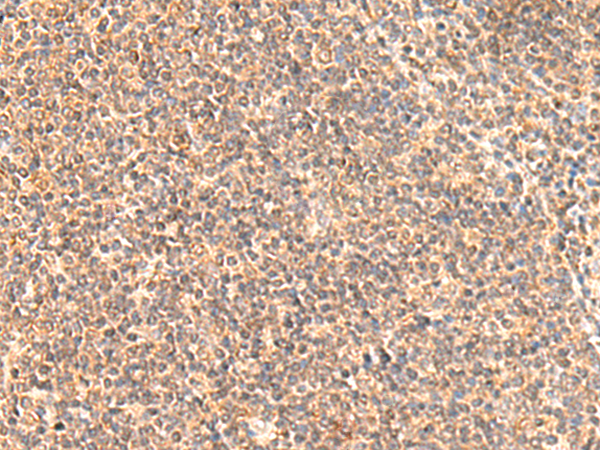 Rabbit Polyclonal Antibody to MOB1A
