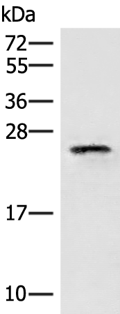 Rabbit Polyclonal Antibody to EIF3K