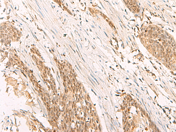 Rabbit Polyclonal Antibody to POP4