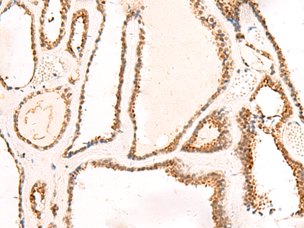 Rabbit Polyclonal Antibody to DCAF10