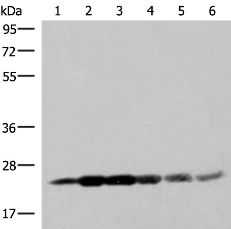 Rabbit Polyclonal Antibody to GSTK1