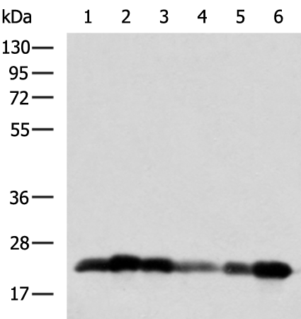 Rabbit Polyclonal Antibody to NEGR1