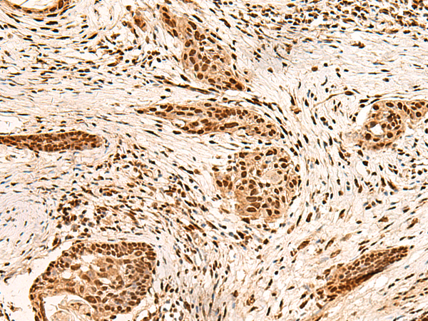 Rabbit Polyclonal Antibody to PAFAH1B2