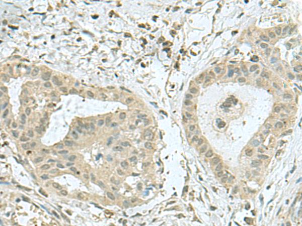 Rabbit Polyclonal Antibody to THTPA