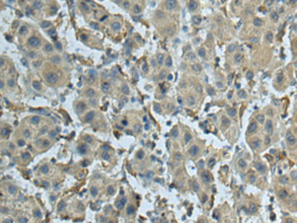 Rabbit Polyclonal Antibody to SCNM1