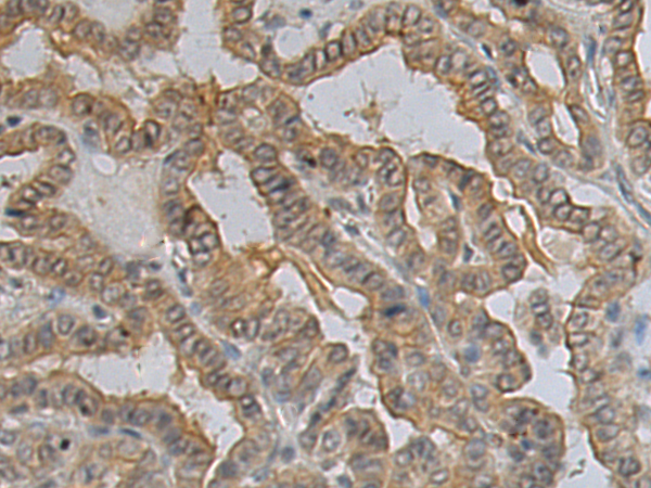 Rabbit Polyclonal Antibody to MAMDC2