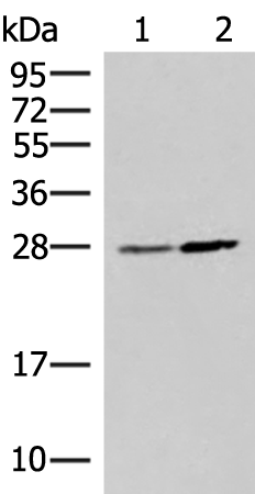 Rabbit Polyclonal Antibody to NAA10