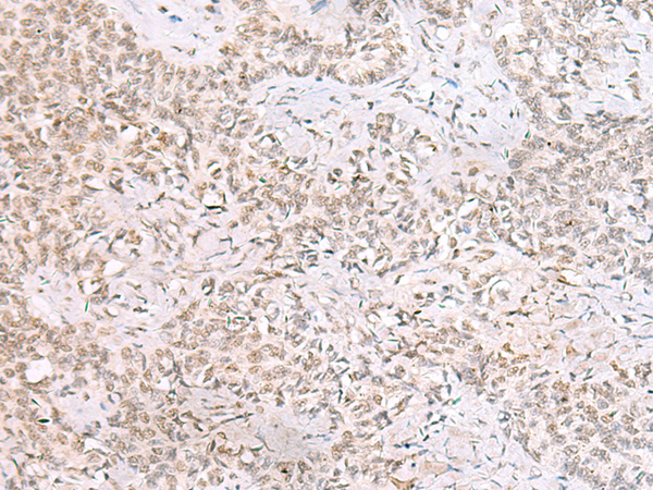 Rabbit Polyclonal Antibody to SMNDC1