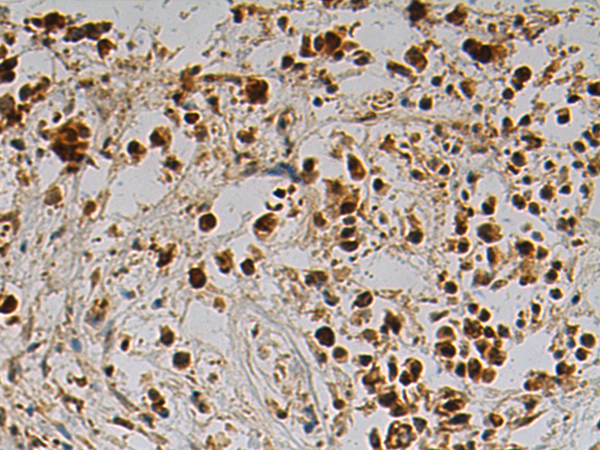 Rabbit Polyclonal Antibody to MACROD1