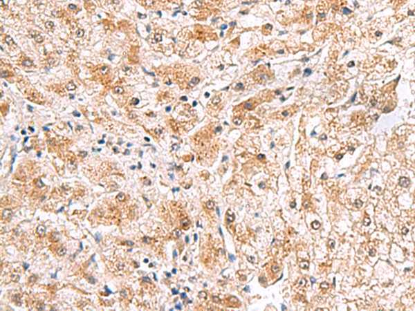 Rabbit Polyclonal Antibody to PDCL2