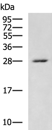 Rabbit Polyclonal Antibody to KCNIP4