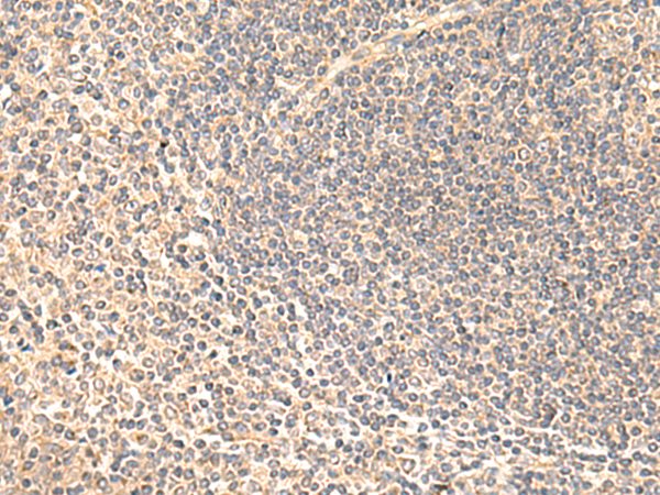Rabbit Polyclonal Antibody to SULT4A1