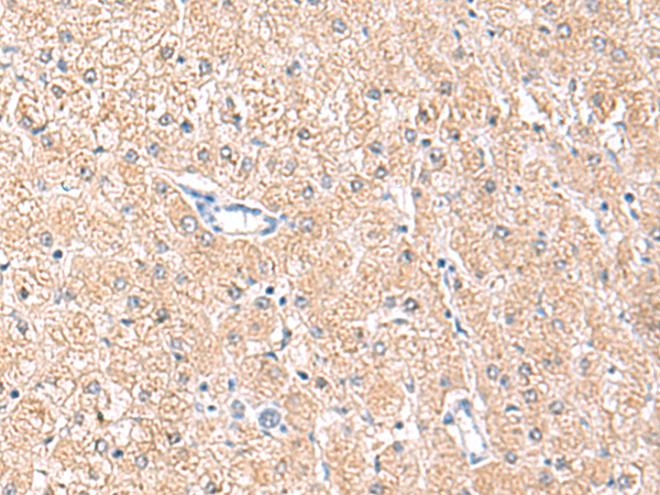 Rabbit Polyclonal Antibody to MLKL