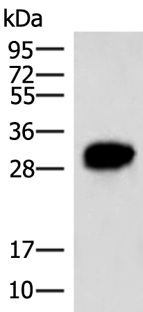 Rabbit Polyclonal Antibody to HCCS