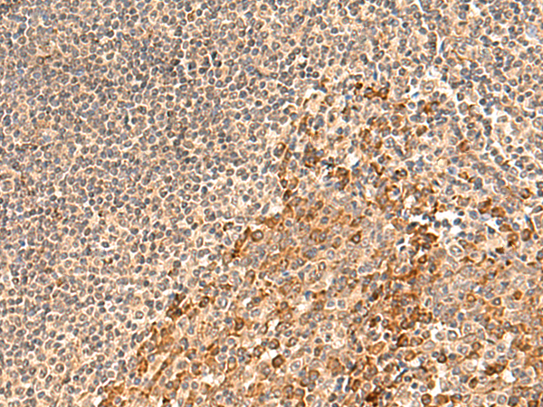 Rabbit Polyclonal Antibody to GALNT12