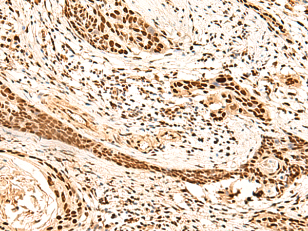 Rabbit Polyclonal Antibody to METTL1