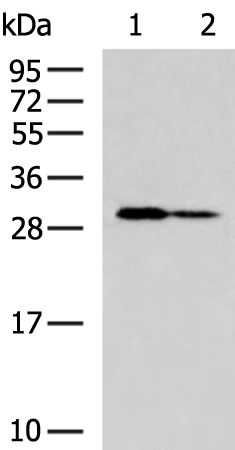 Rabbit Polyclonal Antibody to ZNF688