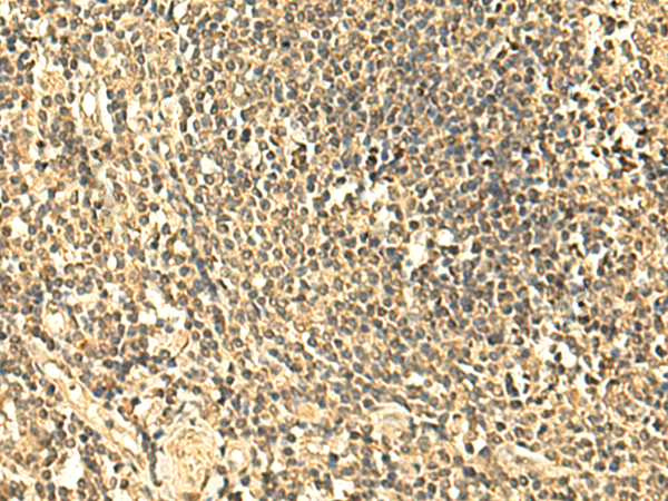 Rabbit Polyclonal Antibody to UNKL