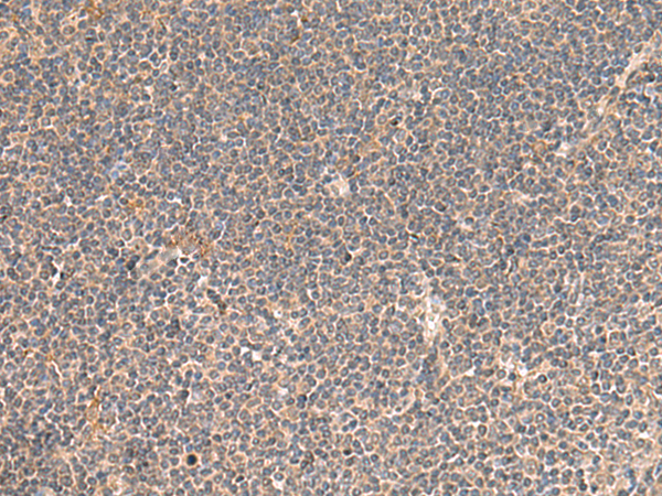 Rabbit Polyclonal Antibody to KCNE3