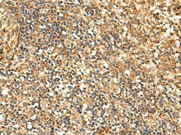 Rabbit Polyclonal Antibody to GLYATL2