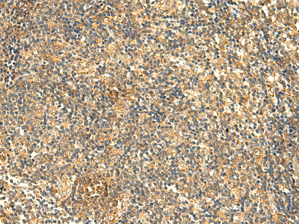 Rabbit Polyclonal Antibody to KIAA0513