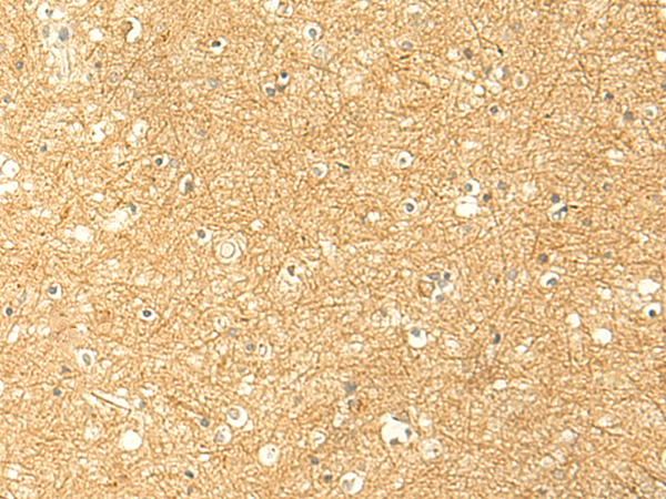 Rabbit Polyclonal Antibody to RNF148